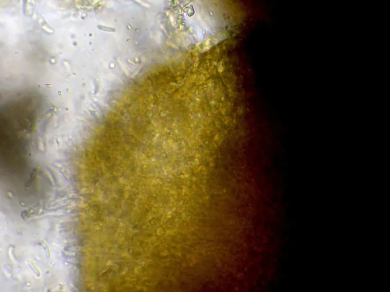 Cytospora curvata 10 - Hifas conidiogenas-002